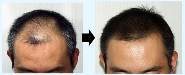 増毛スプレー,増毛スプレー 通販