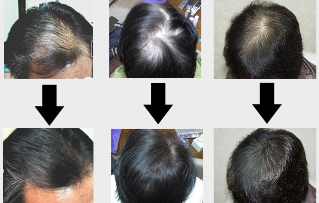 増毛スプレー,増毛スプレー 通販